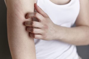 Eine Person kratzt sich am Arm – in seiner Berliner Praxisklinik behandelt Hautarzt Dr. Hasert Hauterkrankungen jeder Art